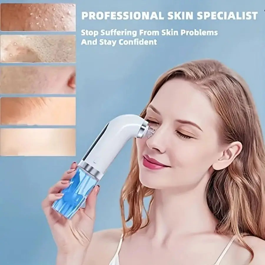 Rechargeable Pore Vacuum Blackhead Remover