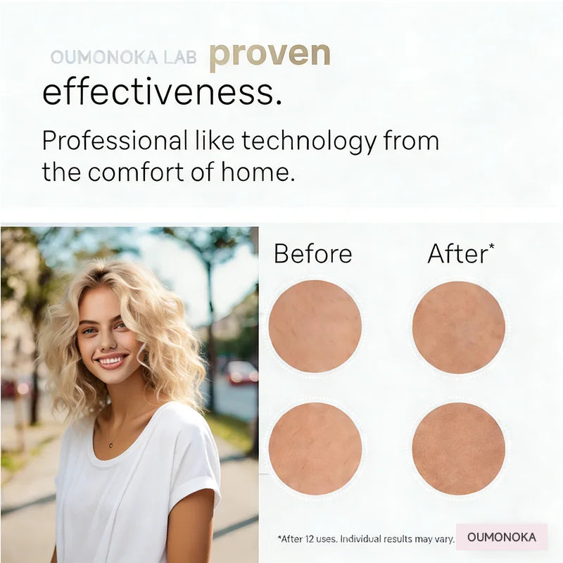 IPL Permanent Hair Removal Device