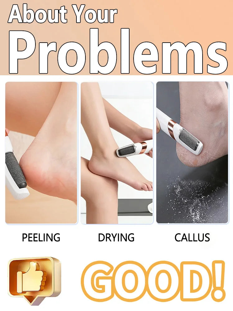 Electric Foot Callus Remover Tool