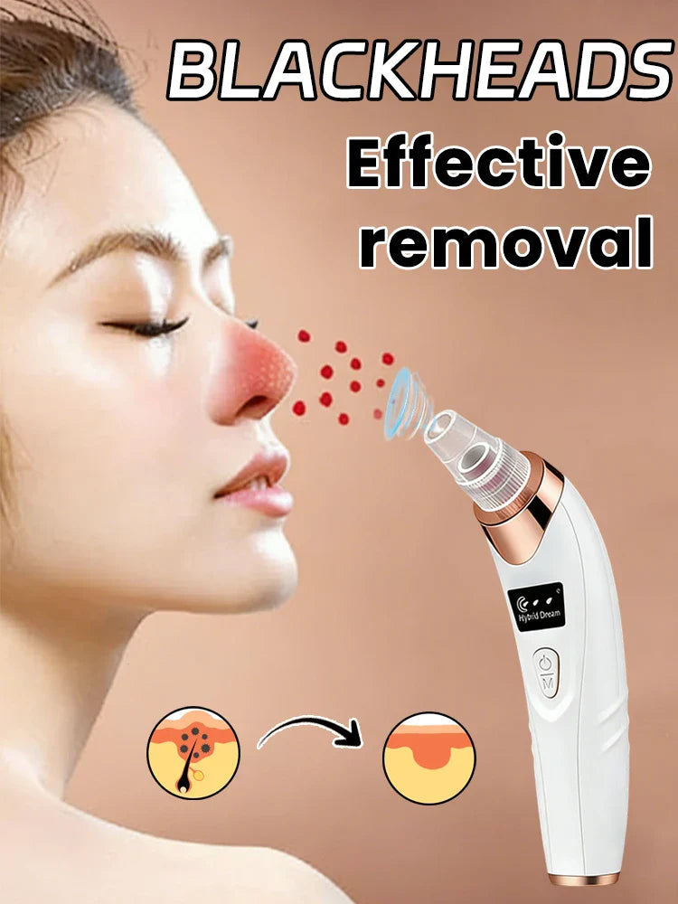 Electric Blackhead Remover Vacuum Tool