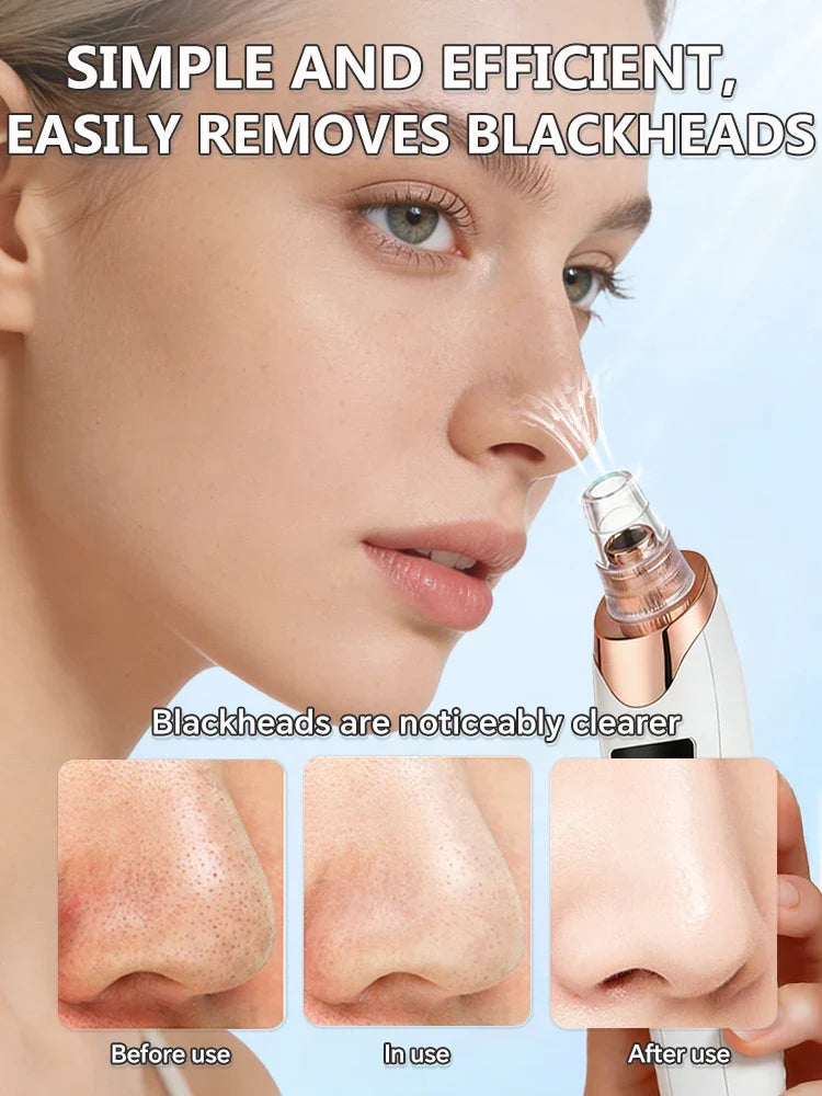 Electric Blackhead Remover Vacuum Tool