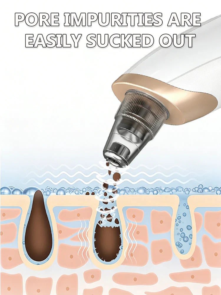 Electric Blackhead Remover Vacuum Tool